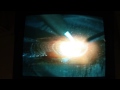 Oxy-Acetylene Fusion Welding