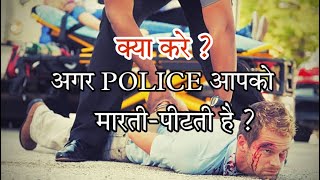 अगर पुलिस आपको मारती है ,तो क्या करे ? |If Police beat you |#police #advocate