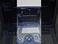 ultrasound portable GE logiq e with GE 8C-RS curvey array probe