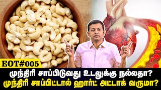 Is cashew good for health? Does eating cashew affect heart health? | #EOT 005 | Dr. Arunkumar