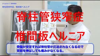 脊柱管狭窄症＆椎間板ヘルニアについてゴッドハンド整体師が解説