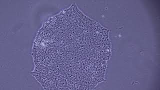 Assessing iPSC Morphology