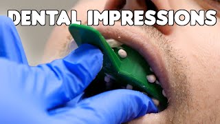Dental Impressions & Pouring Teeth Models