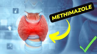 Methimazole: A Breakthrough Medication for Hyperthyroidism Treatment