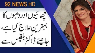 Treatment of  Skin wrinkles by Dr Bilqees | Subh Savaray Pakistan | 5 July 2019 | 92NewsHD