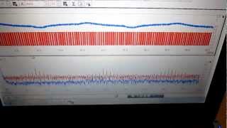 ものの表面を伝搬する弾性波　no.２６　Ultrasonic