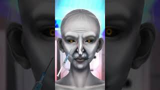 ASMR Face treatment Ghost, Acne, pimples, beautiful girl transformation |injured animation | #shorts