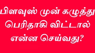 பிளவுஸ் முன் கழுத்து பெரிதாகி விட்டதா ? What will do when blouse front neck becomes large