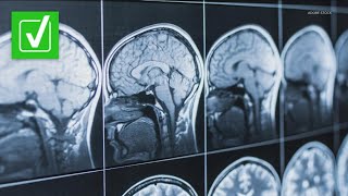 Yes, dementia is fatal. A neurologist explains why