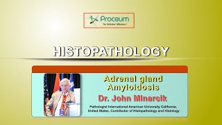 Adrenal Gland Amyloidosis - Histopathology ( John R. Minarcik, MD )