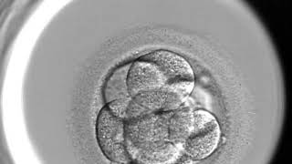 Embryoscope video #1