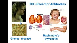 TSH Receptor Antibodies: Nomenclature, Functionality and Assay Comparison