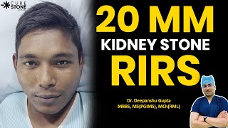 20MM Kidney Stone RIRS | Kidney stone Treatment | गुर्दे की पथरी का इलाज | Patient Testimonial