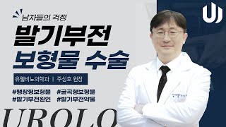 발기부전의 원인과 수술법? 5분안에 알려드립니다