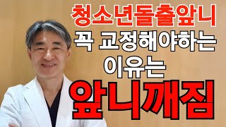 돌출입 (입툭튀) 교정해야하는 이유: 돌출된 앞니가 깨지는것 방지. 앞니신경치료할수도 있음!