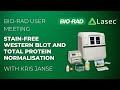 Stain Free Western Blot and Total Protein Normalisation Webinar