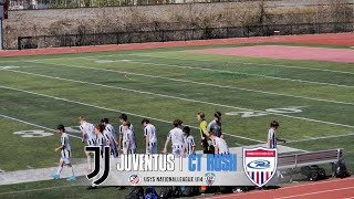 Juventus EDS | CT RUSH