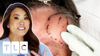 Dr. Lee Removes Golf Ball Sized Cyst From Patients Head | Dr Pimple Popper: This Is Zit l CENSORED
