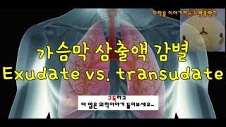 흉수(Pleural fluid): Transudate(여출액)과 Exudate(삼출액) 감별