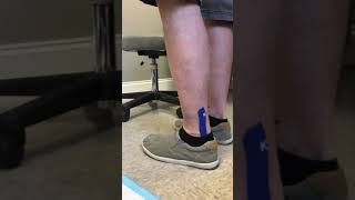 67 Days after heel spur removal and reattachment of Achilles with speed ridge