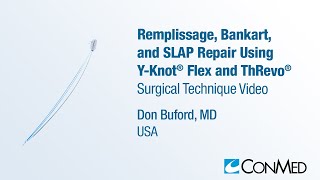 Dr. Don Buford - Remplissage, Bankart, SLAP Using Y-Knot® Flex and ThRevo® - CONMED Technique