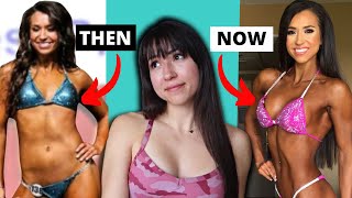 Opening Up About My Plastic Surgeries