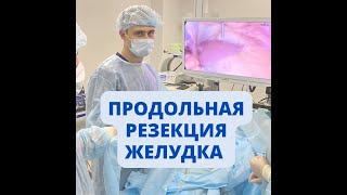 Продольная резекция желудка - самая частая операция по снижению веса. О самом важном...