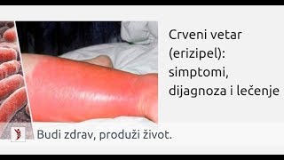 Crveni vetar (erizipel): simptomi, dijagnoza i lečenje