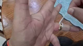 วิธีเอาแหวนที่คับนิ้วออกง่ายๆโดยไม่ต้องตัด//How to remove a ring stuck on finger (Don't have to cut)