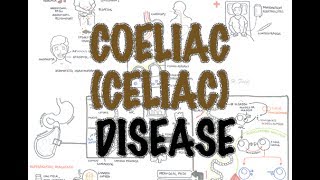 Coeliac (Celiac) Disease - Overview (signs and symptoms, pathophysiology, diagnosis, treatment)