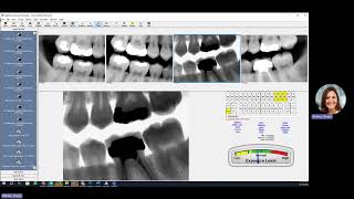 Eaglesoft Imaging Module