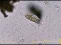 ピーナツ状の繊毛虫a peanut shaped ciliate