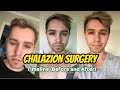 Chalazion Surgery Healing (Timeline) before and after