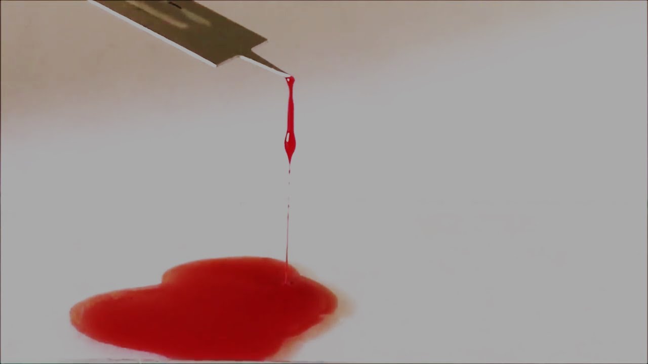 Determination Of Blood Clotting Time By Slide Method | Blood Clotting ...