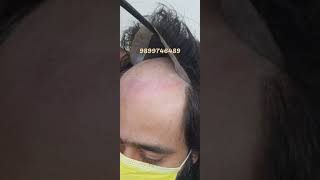 Amazing Hair Transformation 😍 | Best Hair wigs for men in delhi #hairpatch #shorts #viral #trending