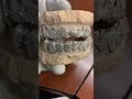 why diamond dust grillz are so popular