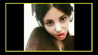 Sahar Tabar Before & After Plastic Surgery Angelina Jolie's Fan| Corpse Bride