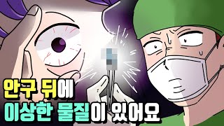 체리툰 | 안구 뒤에 이상한 물질이 있다고?!😱👀 | 영상툰/썰툰/일상툰 | 설렘썰/공포썰/고민썰/개그썰