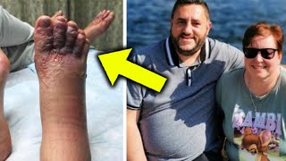 Couple Noticed Their Feet After Walk On Beach, Doctors Refused To Help