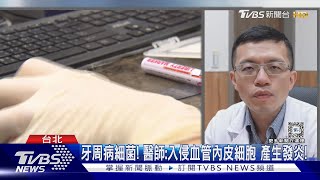 牙..刷不乾淨.....口腔細菌導致罹患「這個癌」?! 醫師說真相.............｜十點不一樣20240525 @TVBSNEWS01