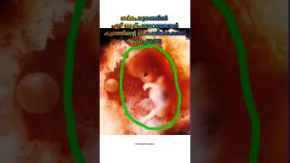 അമ്മയും കുഞ്ഞും തമ്മിലുള്ള പൊക്കിൾക്കൊടി ബന്ധം... 🤰🤰#pregnancy #baby #shorts #short