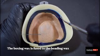 Beading and boxing of maxillary complete denture impression|step by step