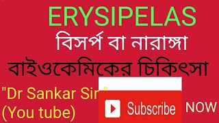 ERYSIPELAS | 'DR SANKAR SIR | SANKAR DATTA GUPTA. | বিসর্প বা নারাঙ্গা |  বাইওকেমিকের চিকিৎসা |