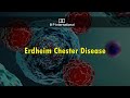 Erdheim Chester Disease