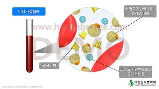 [시연용] l0017agko [대한당뇨병학회] 제8장, 당뇨병의 합병증 (7) 만성 합병증 : 고혈압과 이상지질혈증