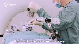 Micromate™ Case Testimonial |  Lung Biopsy