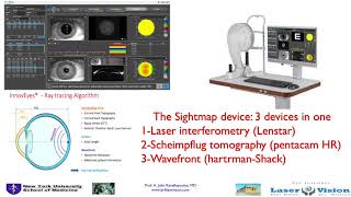 Ray-tracing customization of myopic LASIK: Alcon's Innoveyes; Kanellopoulos, MD