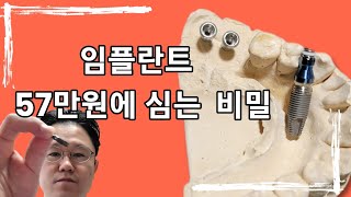 임플란트 57만원 심는 비밀