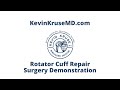 Rotator Cuff Repair Surgery Demonstration - Dr Kevin Kruse MD