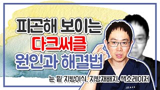 피곤해 보이는 다크써클의 원인과 해결법(눈 밑 지방이식, 지방재배치, 색소레이저)